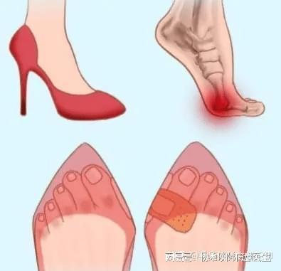 备的高筒靴小心背后隐藏的安全隐患！qmh球盟会亚博网址爱美女孩冬季必(图1)